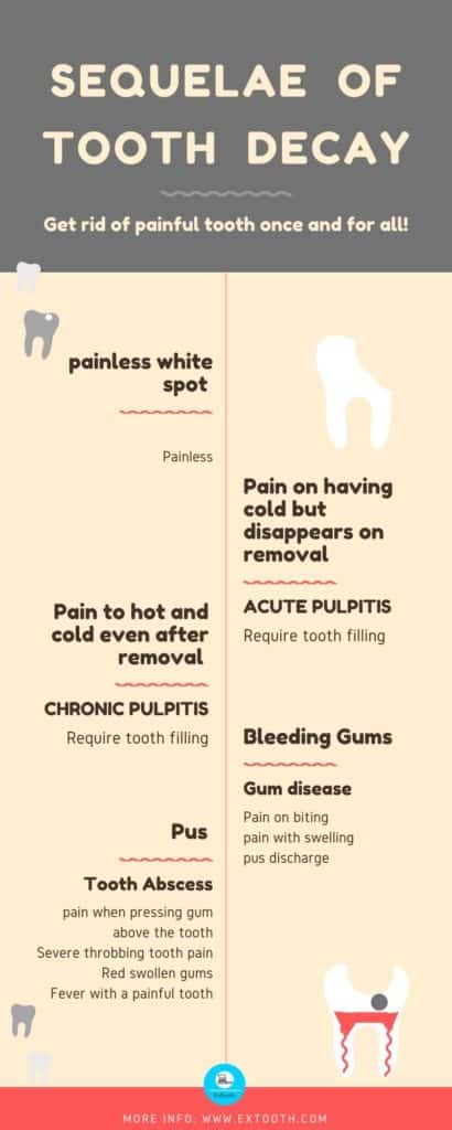 The sequence of tooth decay