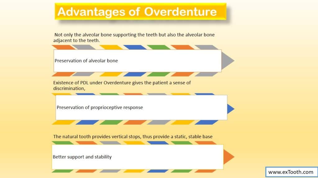 advantages of overdenture