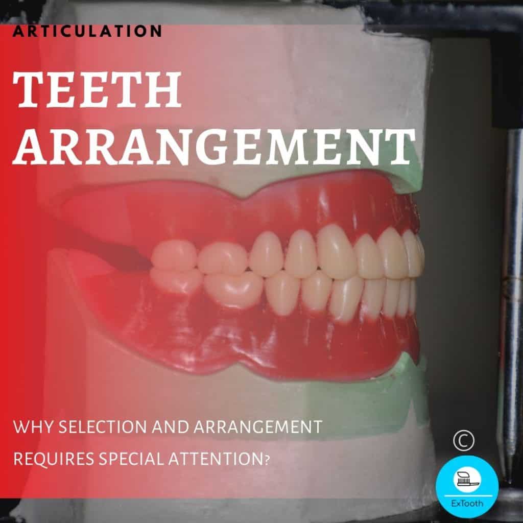 teeth arrangement
