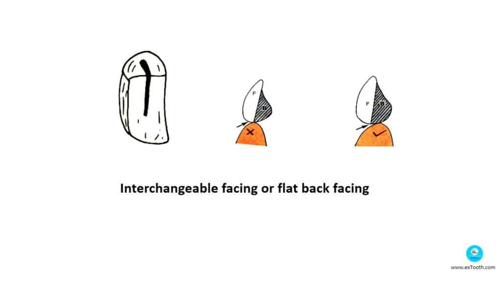 Interchangeable facing or flat back facing