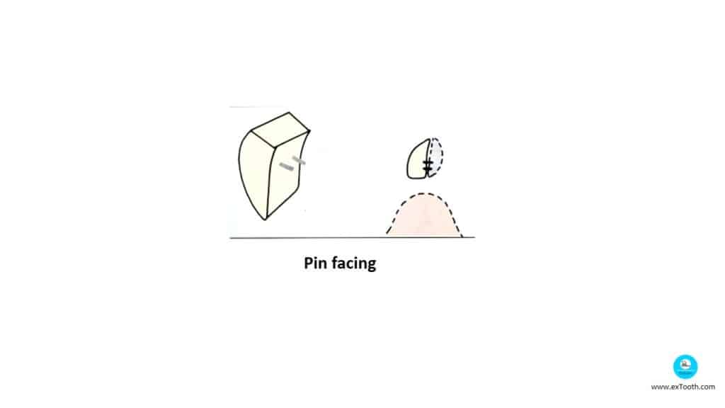 Pin facing