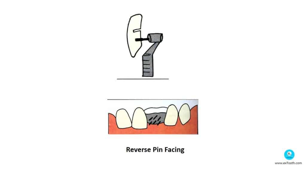 Reverse Pin Facing