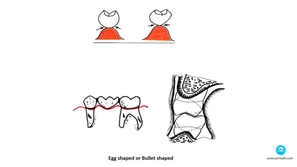 Egg shaped or Bullet shaped