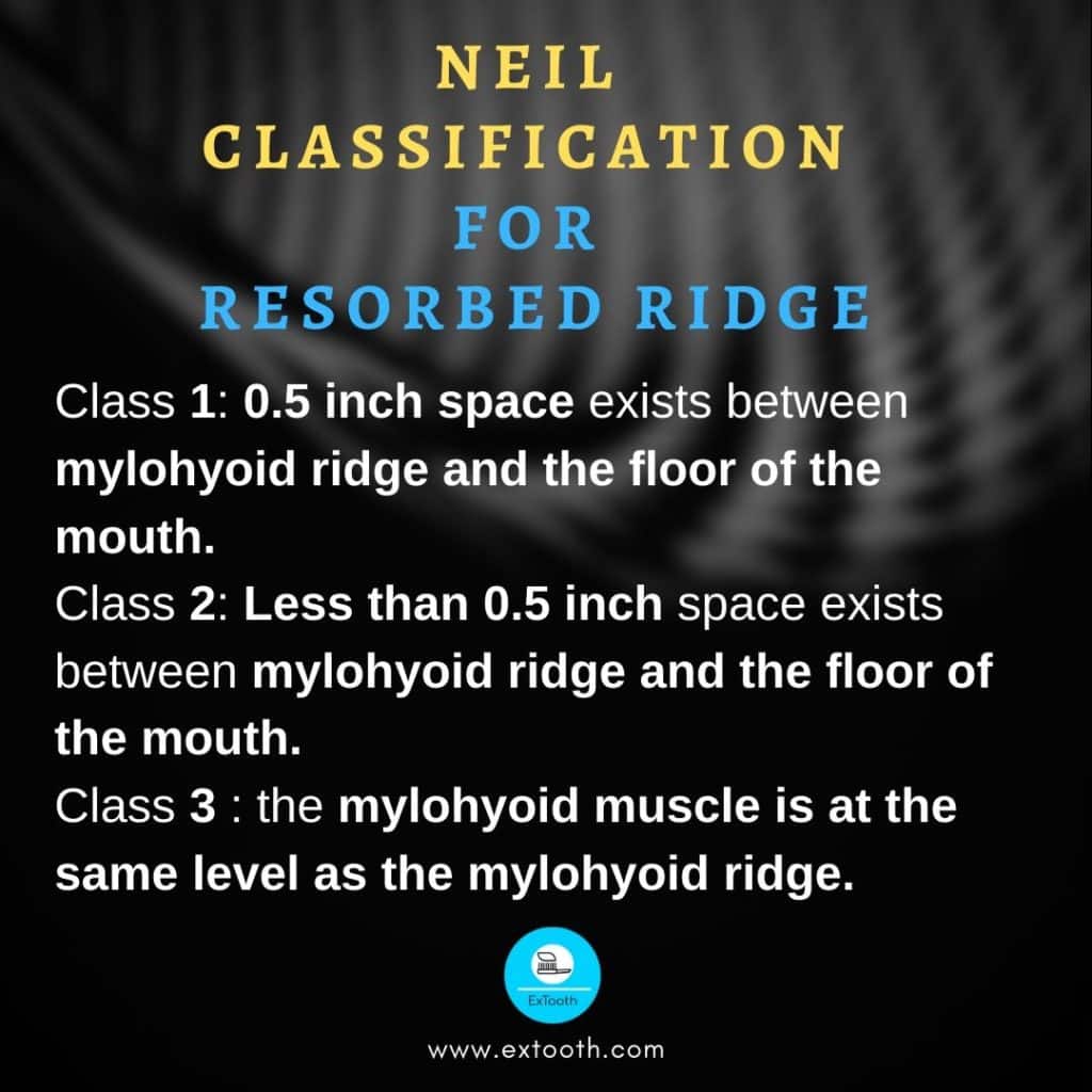 Neil classified residual ridge resorption