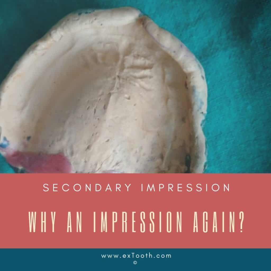 Why an impression again- secondary impression?