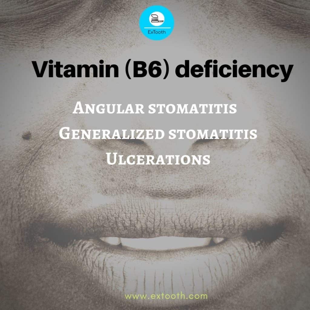 VIT B 6 - nutrition and oral health