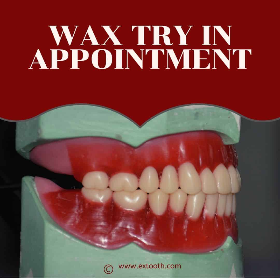MASTERING DENTURE WAX TRY IN APPOINTMENT extooth
