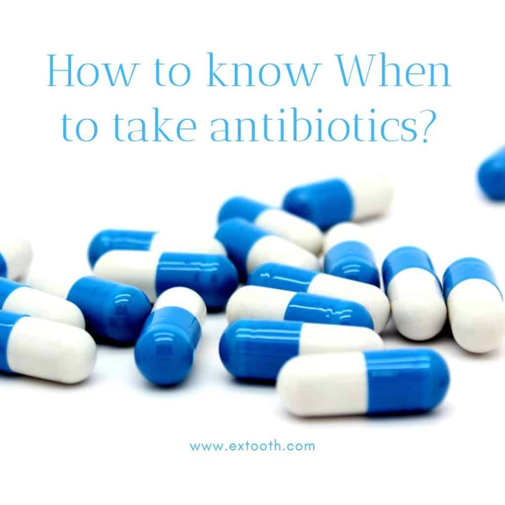How to know When to take antibiotics?