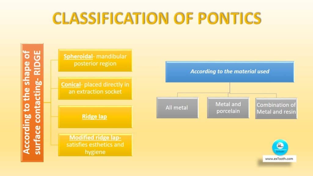 classification of pontics