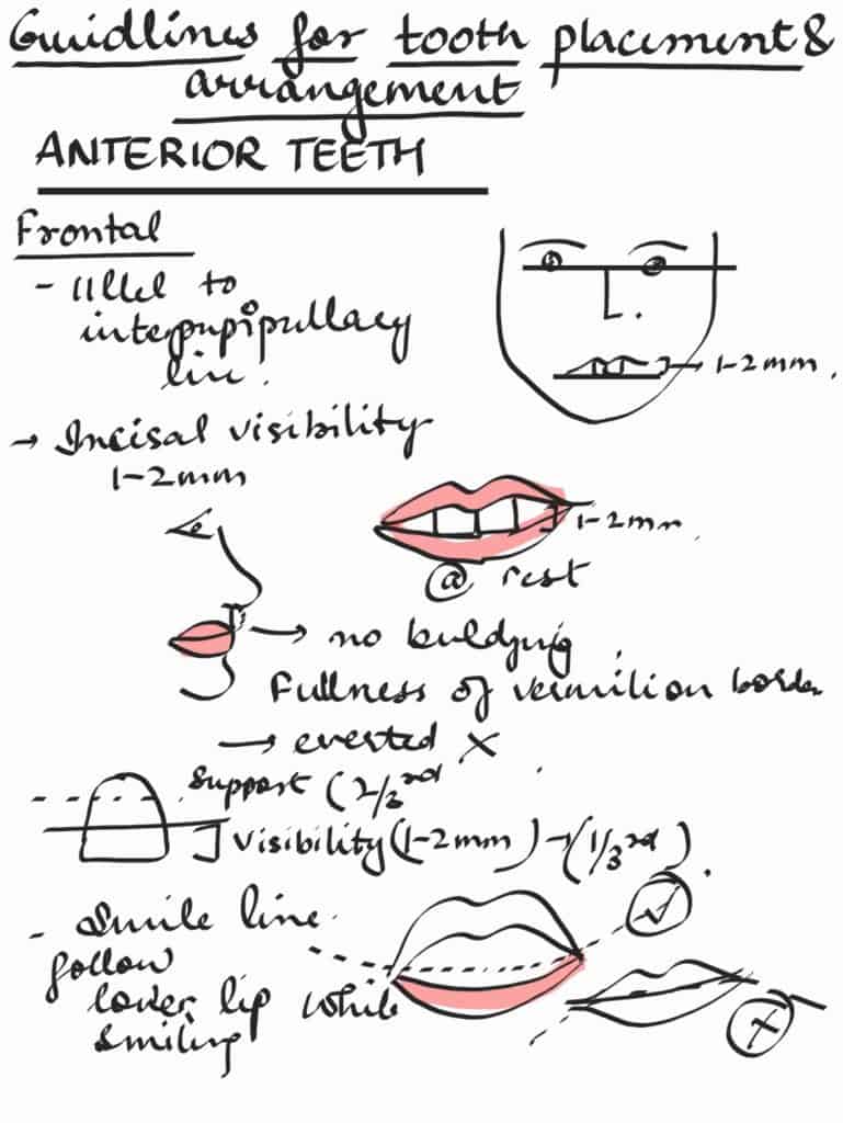 teeth arrangement in complete denture - anterior teeth