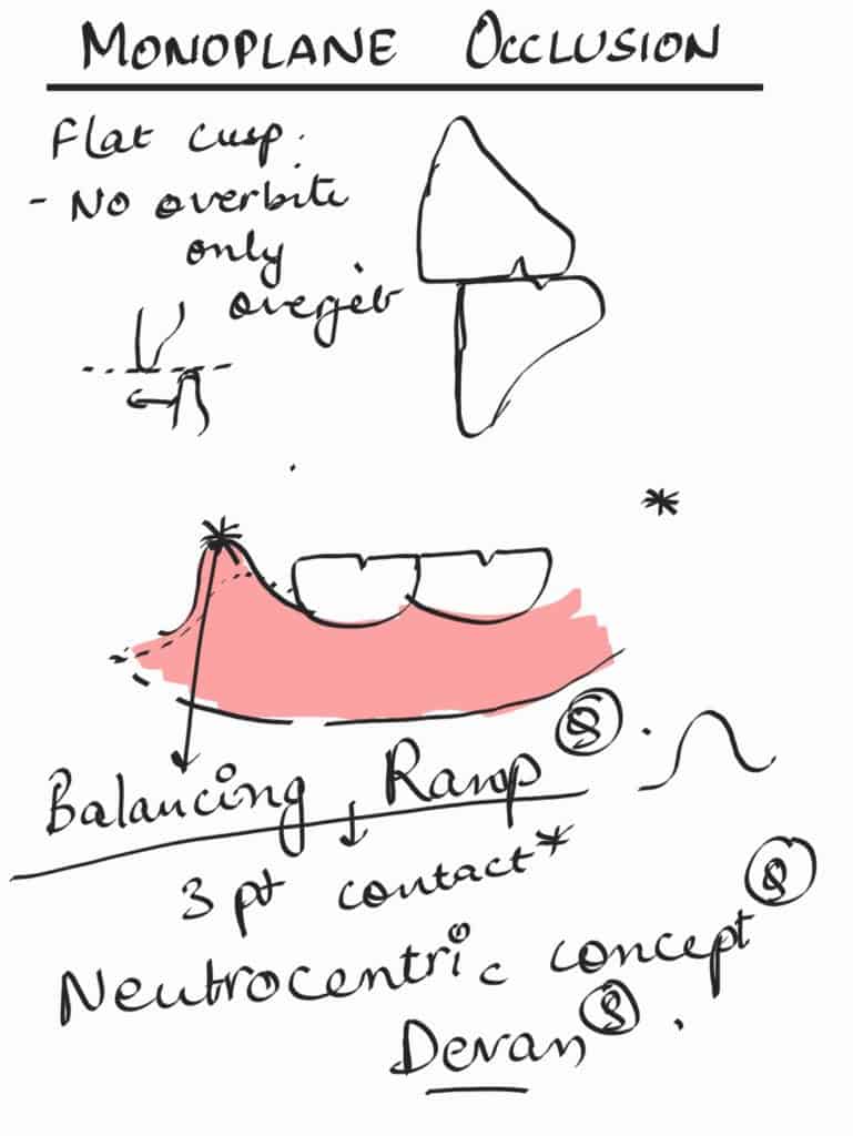 mono plane occlusion in complete denture