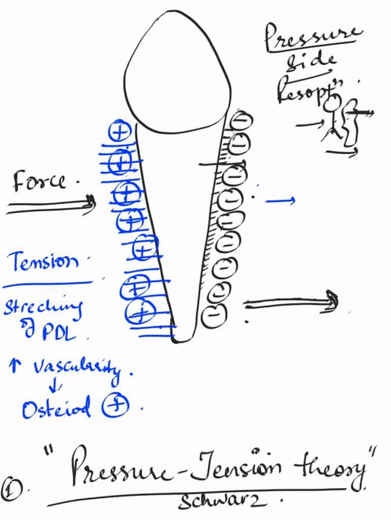pressure tension theory in orthodontics