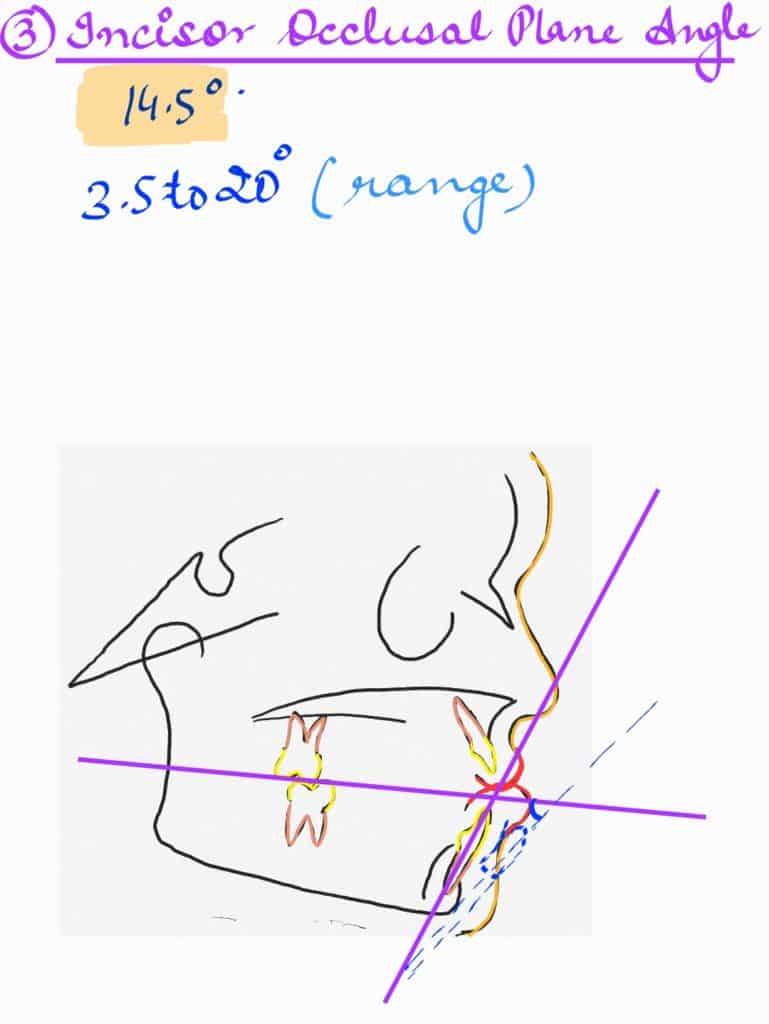 incisor occlusal plane angle in orthodontics