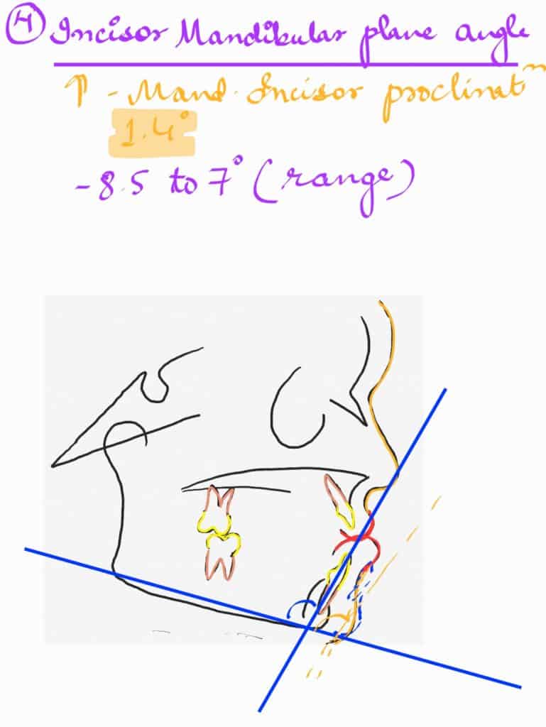 incisal mandibular plane angle in orthodontics