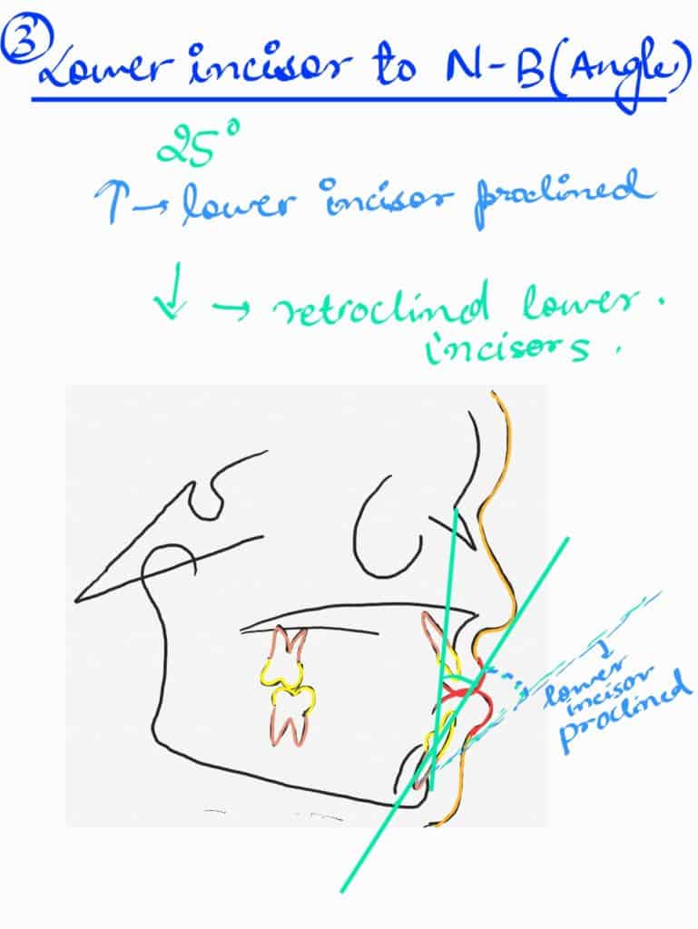 lower incisor to n-b(linear) in orthodontics