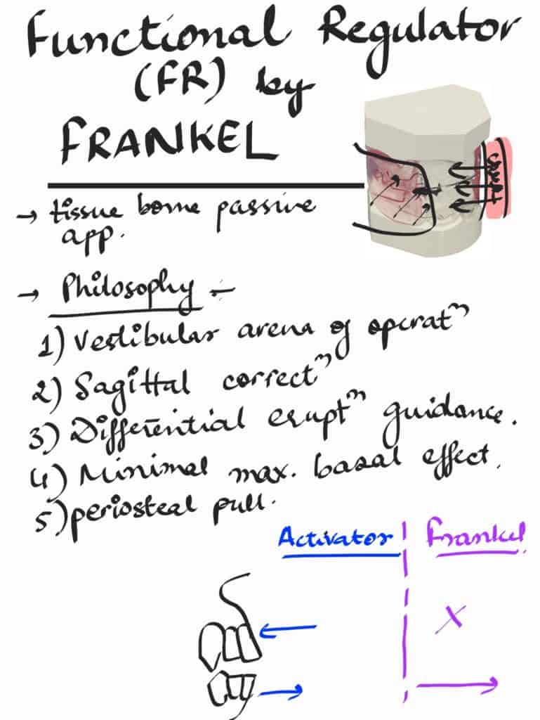 frankel regulator in orthodontics