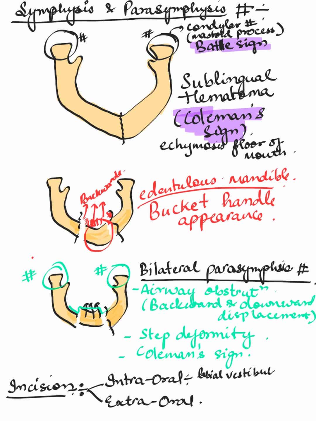 oral and maxillofacial surgery revision - extooth