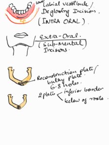 oral and maxillofacial surgery revision - extooth